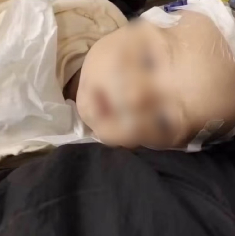 四川6月齡男嬰確診心衰、重癥肺炎：治療缺錢 母親發(fā)起求助(圖2)